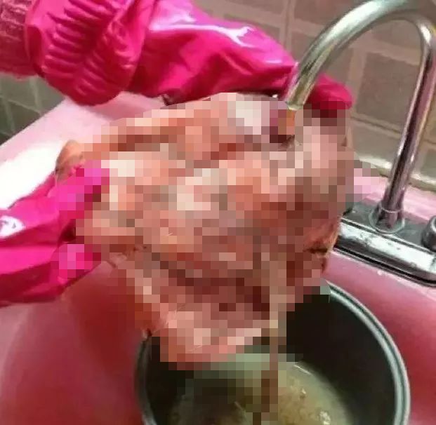 女星用自己胎盘当补药，揭秘人体胎盘｜Youth予小希观察