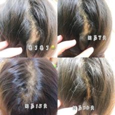 90后怎么防脱 (90后该如何防脱)