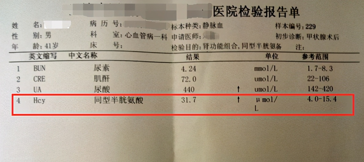 损伤大脑的罪魁祸首,同型半胱氨酸高对血管有影响吗