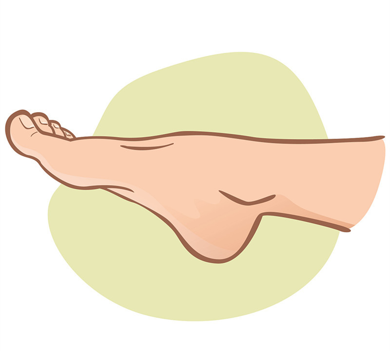 霉菌会引起皮癣吗,霉菌感染就是癣吗