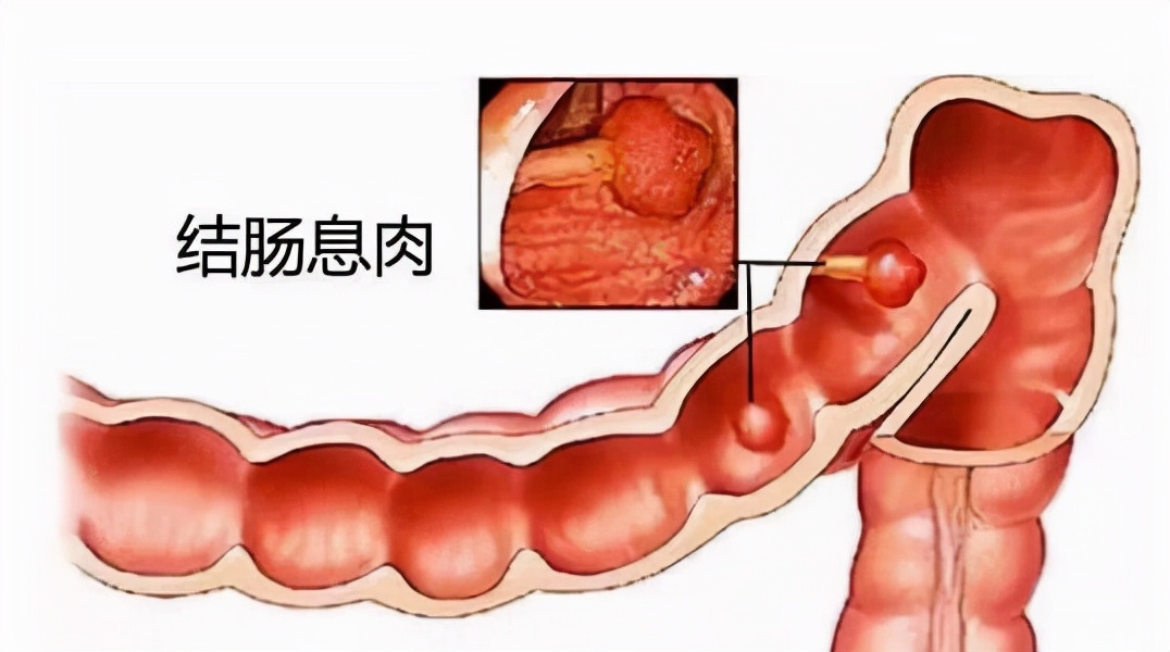 中医大便前面硬后面软是什么原因,大便前硬后软有什么好的方法治吗