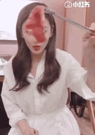 张雨绮说做超声刀就像在烤肉?我去体验了一把……