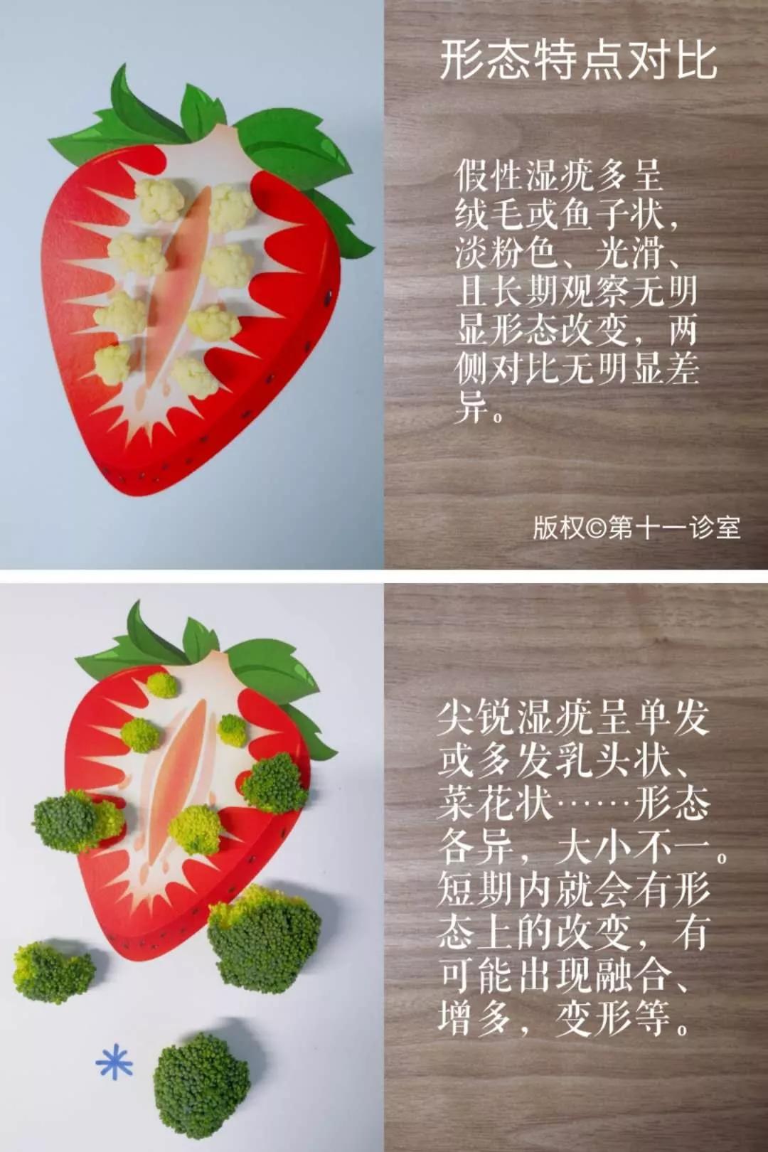 尖锐性湿疣与假性湿疣最大的区别,假性湿疣和尖锐性湿疣对比