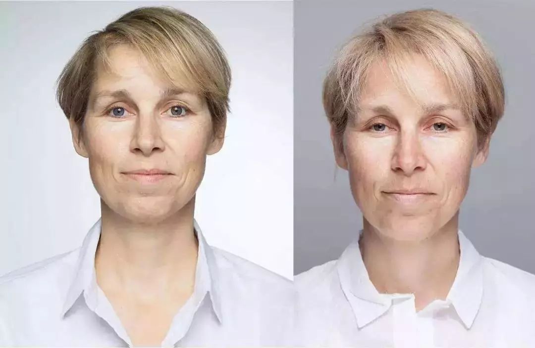 关晓彤有没有黑眼圈,关晓彤黑眼圈困扰