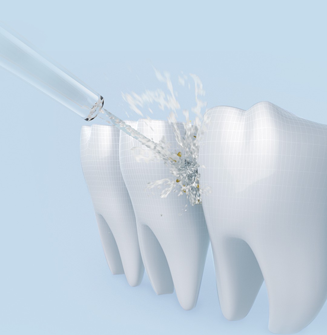 小米米家电动冲牙器拆解,小米官方旗舰店直播冲牙器