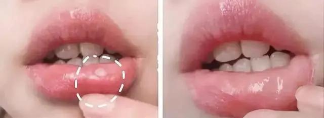 一张嘴就臭,一张嘴就口臭小妙招