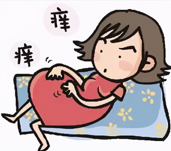 妊娠痒疹要怎么治疗,妊娠痒疹是怎么治愈