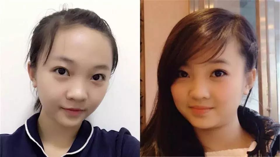 法令纹显老10岁三种方法帮助改善,最显老的法令纹怎么改善