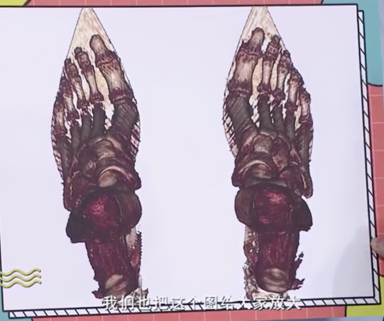 怎么选择适合自己脚型的鞋,怎样选一款适合自己脚型的鞋