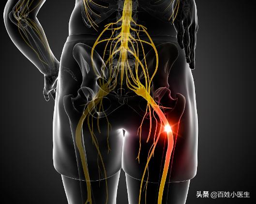 坐骨神经腿部按摩手法全部过程,腰椎狭窄压迫坐骨神经痛能按摩吗