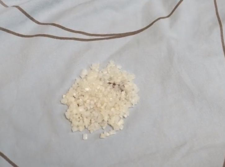 如何去除床单上顽固血渍,床单上的新鲜血渍怎样快速清除