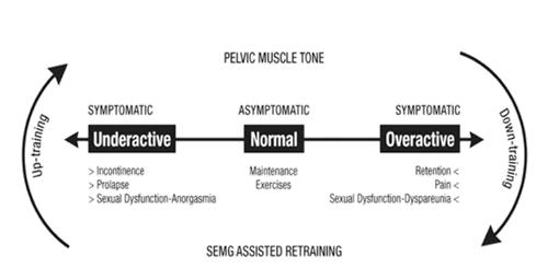 不用脱裤子,也能做,产后康复的7个冷知识