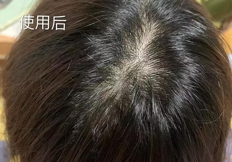 洗发水推荐控油蓬松樱花,claynal樱花洗发水推荐