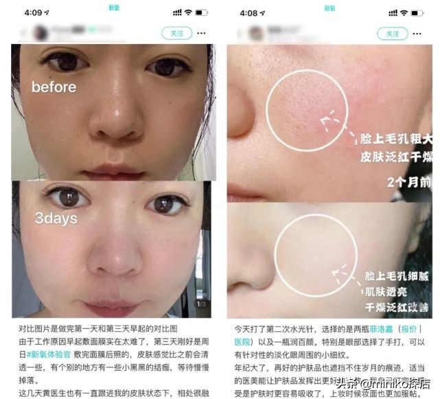 沙漠大干皮敏感肌救星,沙漠干皮救星视频