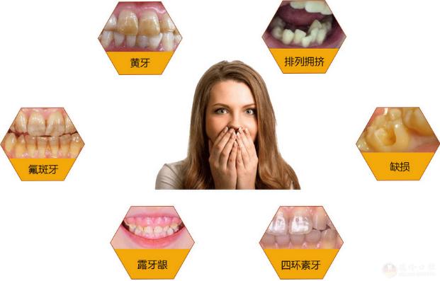 牙齿发黄如何变白有什么方法,牙齿发黄怎么办教你一招变白