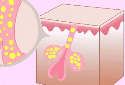 宋威龙对赵露思的评价,宋威龙痘痘肌