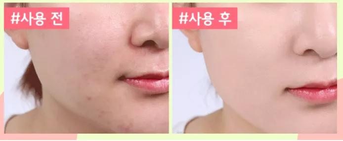 oliveyoung必买护肤品,韩国oliveyoung精油