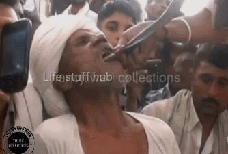 吸蛇毒中毒,吸蛇毒血片段