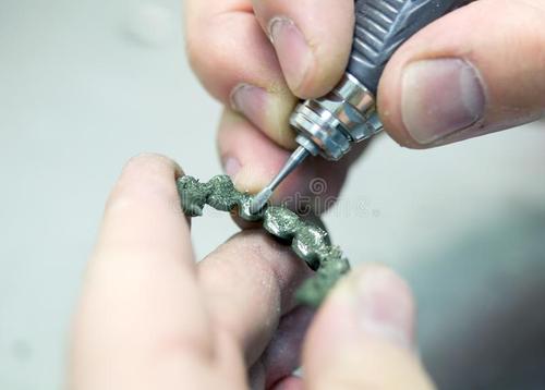 为什么有的烤瓷牙特别贵,烤瓷牙从几百到几千有什么区别