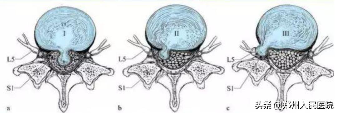 对骨科微创技术的认识,骨科手术与保守治疗对比