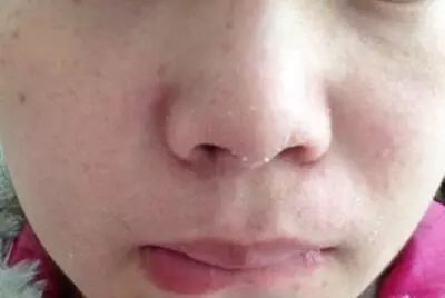 国货修护祛痘印护肤品推荐,堪比大牌平价护肤品