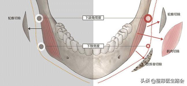 大方脸女生的优点和缺点,大方脸怎么改变脸型