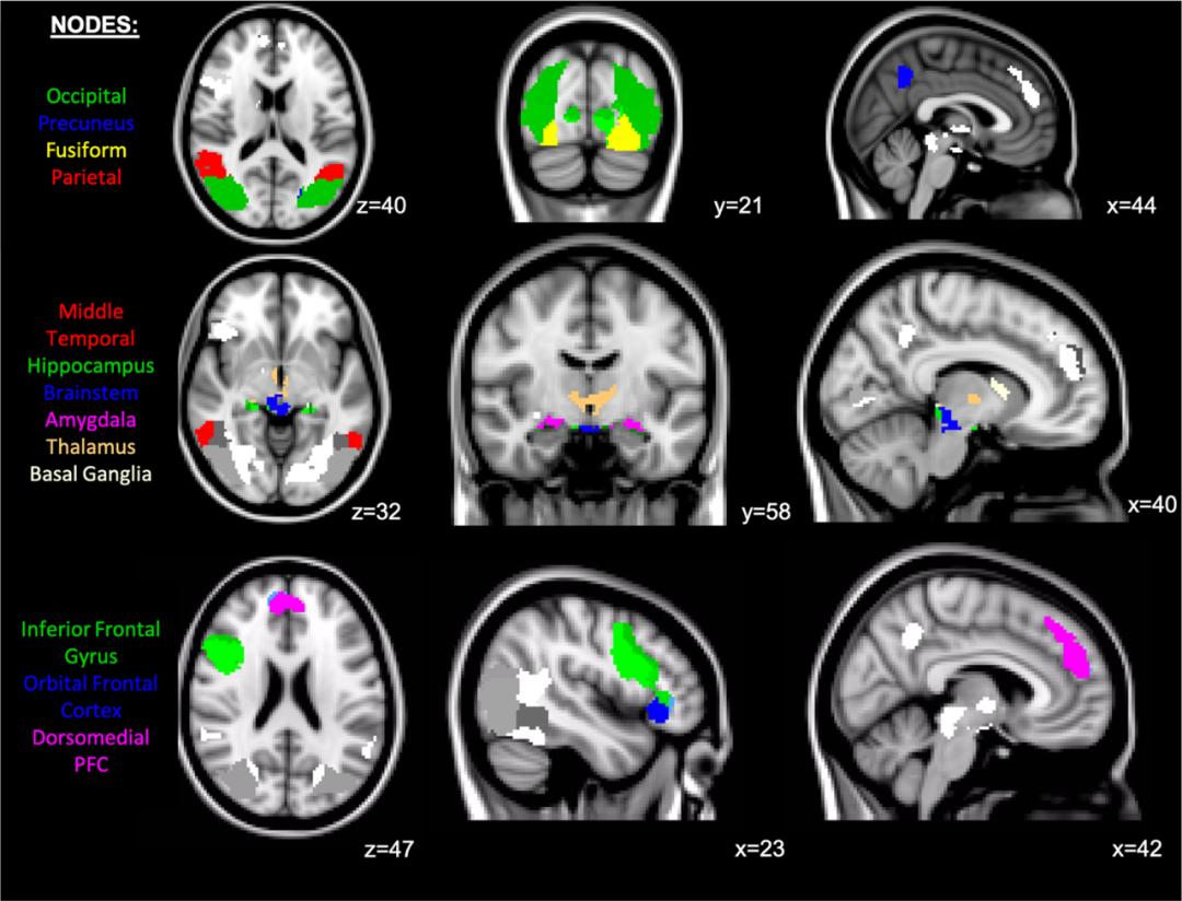 抑郁生物标志物,重度抑郁症患者神经元