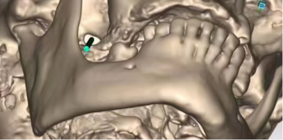 合肥华安脑科康复医院,合肥华安脑科医院