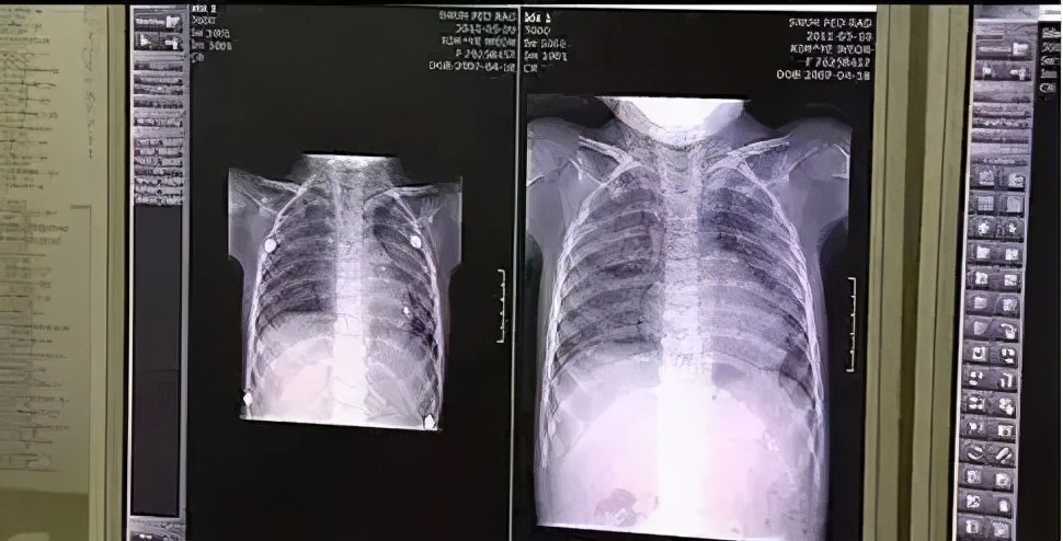 韩国加湿器致死事件原因 (韩国加湿器致死事件是真的吗)