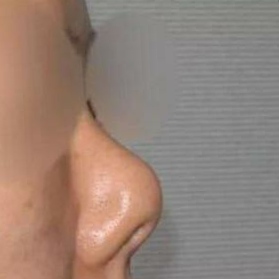 有哪些明星是朝天鼻,塌鼻好看的明星