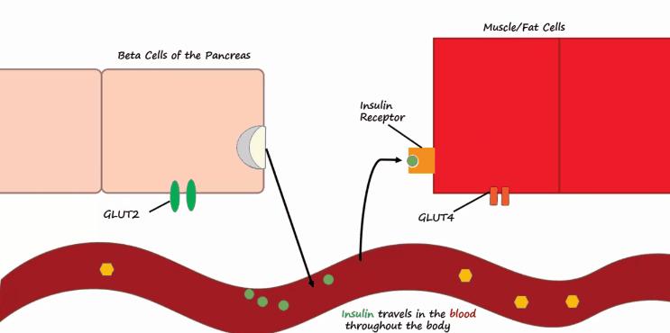 胰岛素是如何导致糖尿病的,胰岛素增多为什么会导致糖尿病