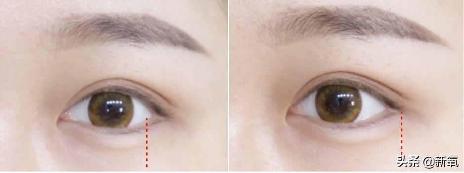 sunshine组合成员现状,sunshine组合重组