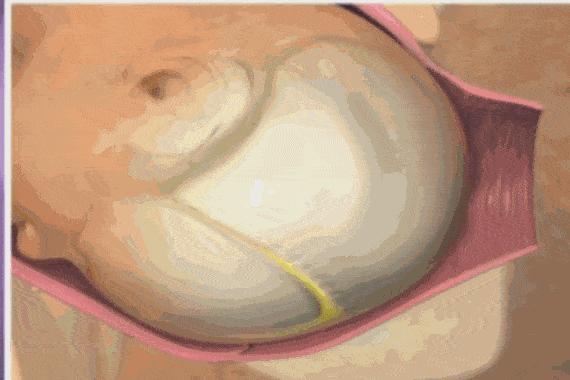 孕妇胎儿动图,3d动图视频怎么做