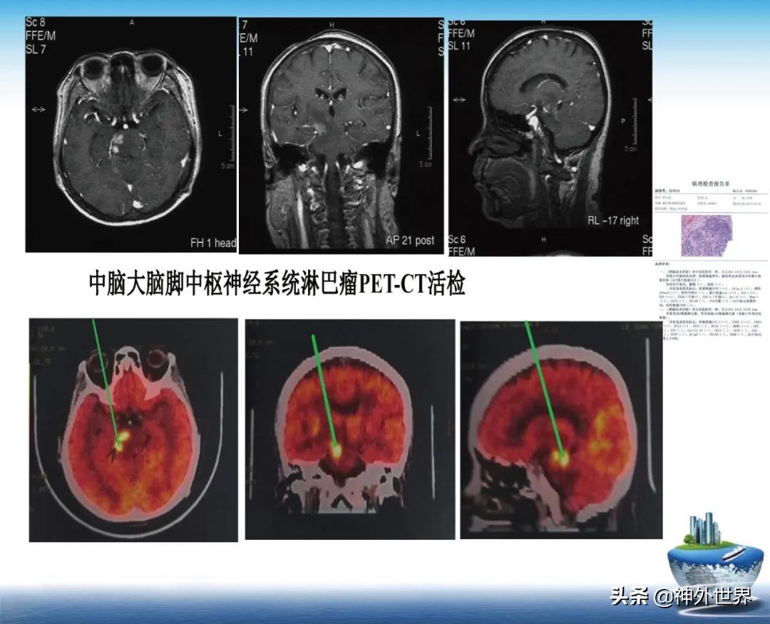 宣武医院神经外科王亚明祖籍,北京宣武医院神经科专家王亚明