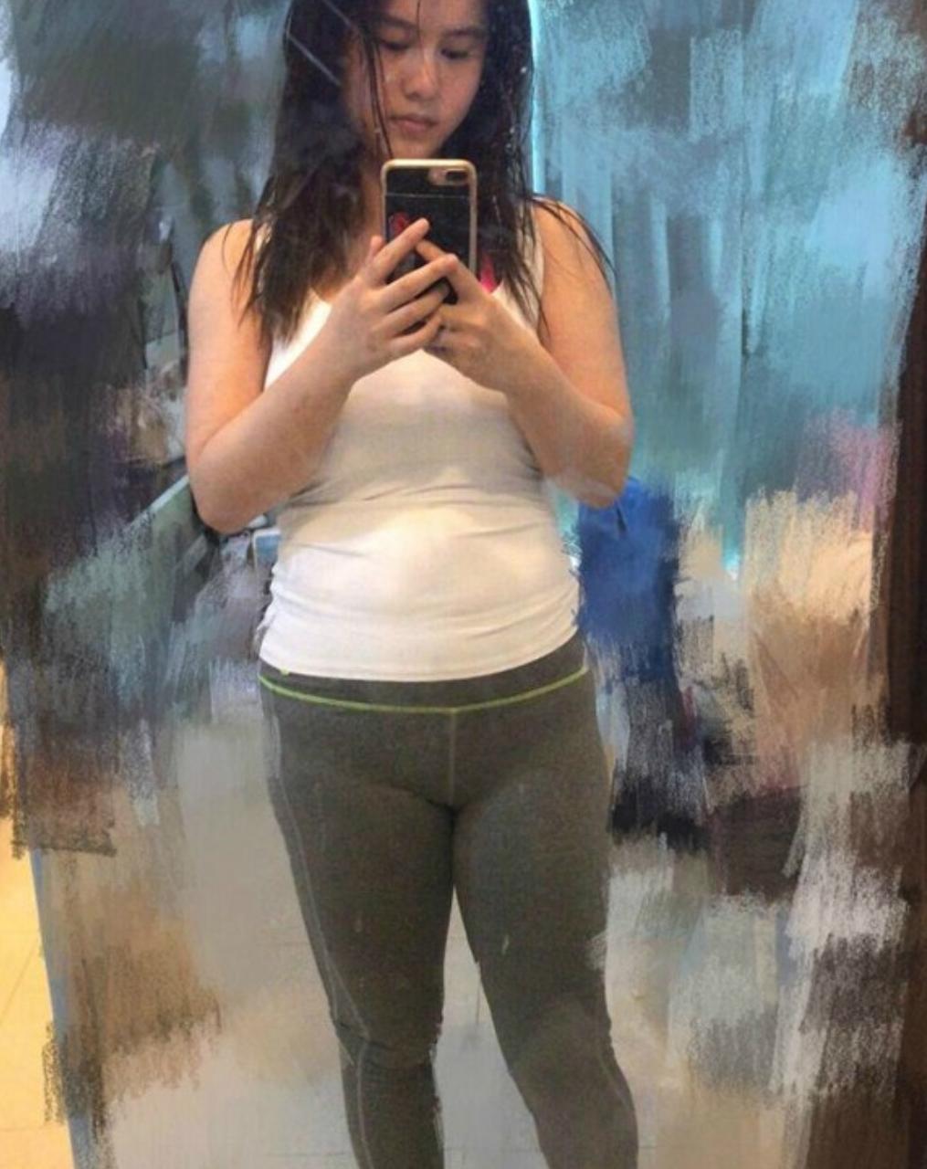 宅男女神邓月平戒口吃“草”曾荷尔蒙失调惹湿疹满身抓痕