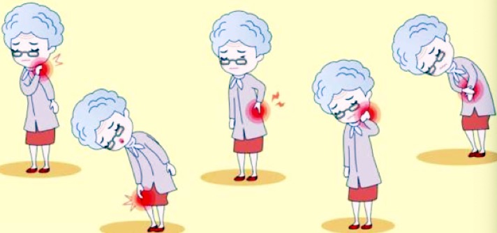 70种灸法秘传,灸法的重大突破