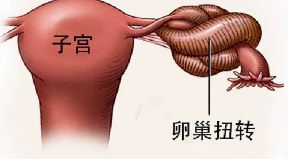 捐卵黑幕,捐卵骗局真人