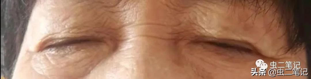 白虎汤加人参配方和量,人参白虎汤的名中医运用经验