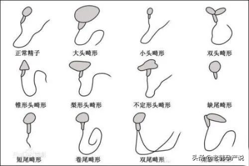 精子质量的评判标准和如何调理,精子活力与精子合格率