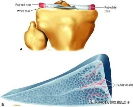 半月板撕裂关节镜手术后能痊愈吗,半月板撕裂关节镜手术后恢复时间