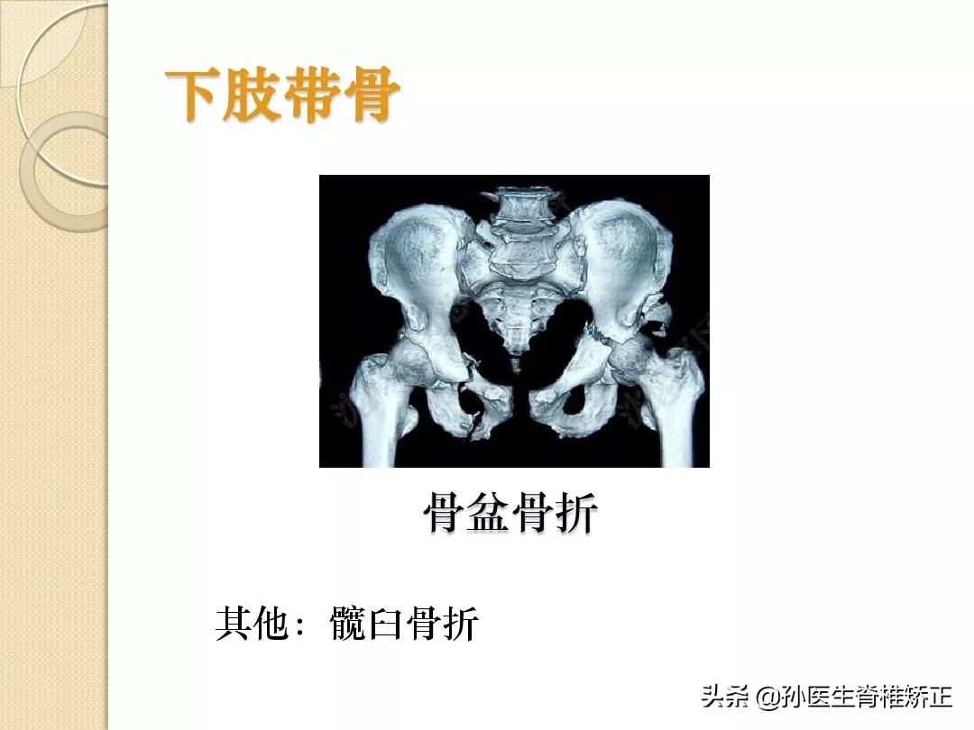 人体解剖学骨骼学思维导图,人体骨骼解剖学纪录片