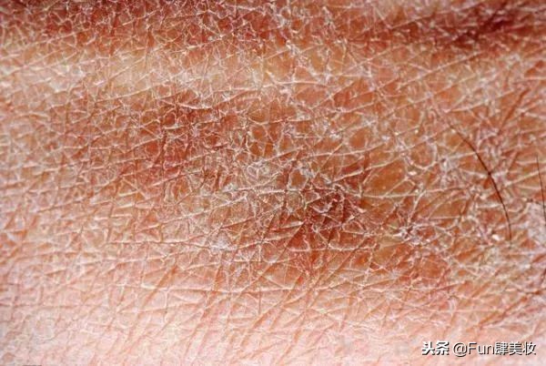 别瞎忙了!真正的好皮肤是这样养出来的!