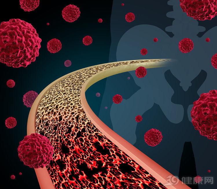 肿瘤转移放弃治疗,肿瘤转移只做免疫治疗