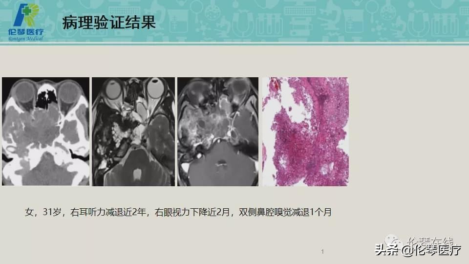 上海教授詹松华,上海曙光医院詹松华简介