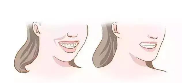 嘴型丑的怎样让嘴唇变得好看,嘴型不好看怎么练才能矫正