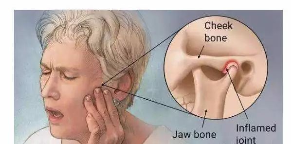 热水袋敷脸能缓解颞下颌脱位吗？