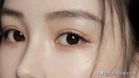 全切双眼皮后怎样涂抹疤痕药,做全切双眼皮多久可以用祛疤药