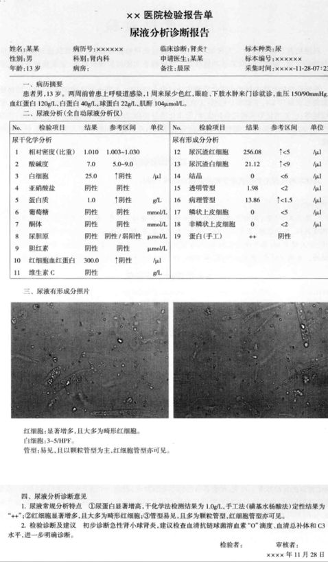 十分钟教你看懂尿常规,手把手教你看懂尿常规