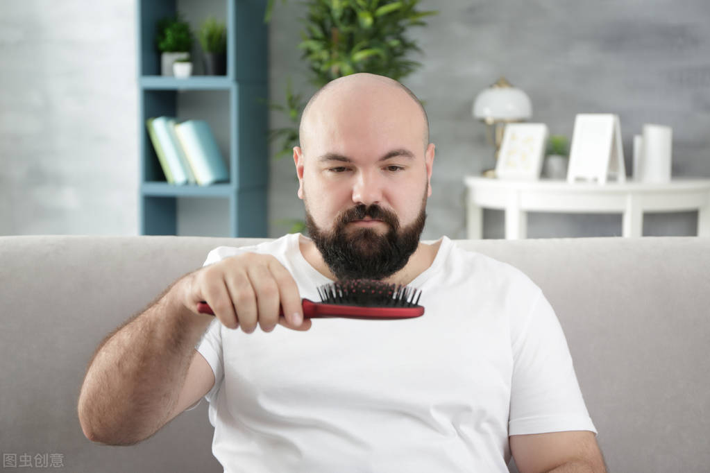 脱发也能脱出自己的风格