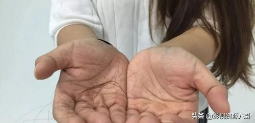 *处私**的毛发为何是卷的?这些相关的秘密,了解一下有好处